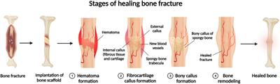 Additively manufactured porous scaffolds by design for treatment of bone defects